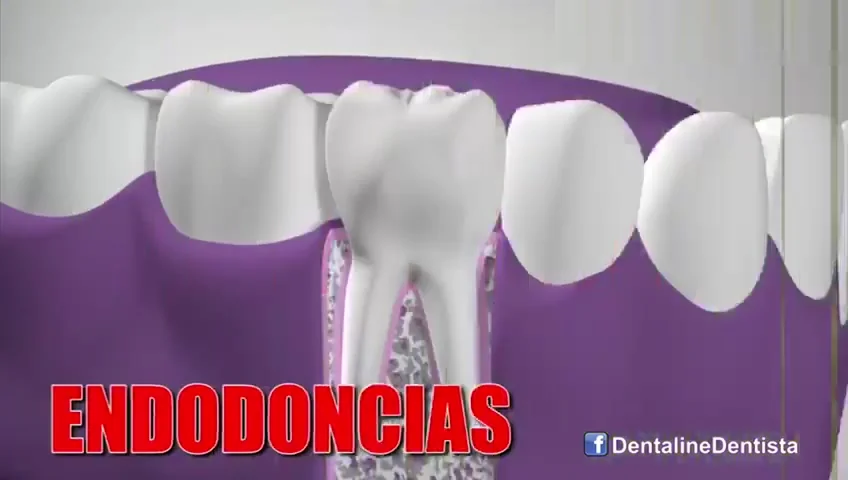 Endodoncias — Dentaline